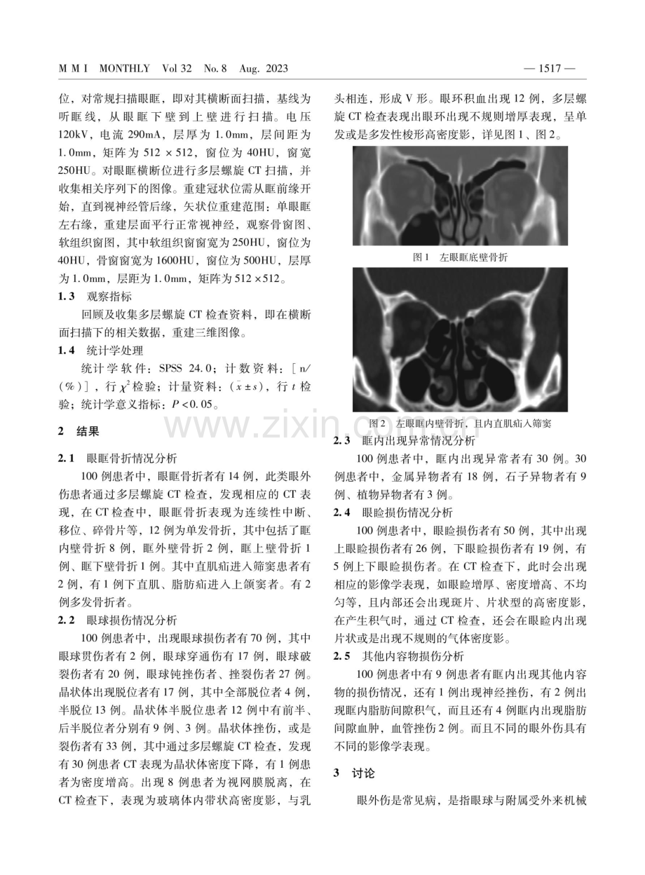 多层螺旋CT诊断眼外伤的临床应用价值.pdf_第2页