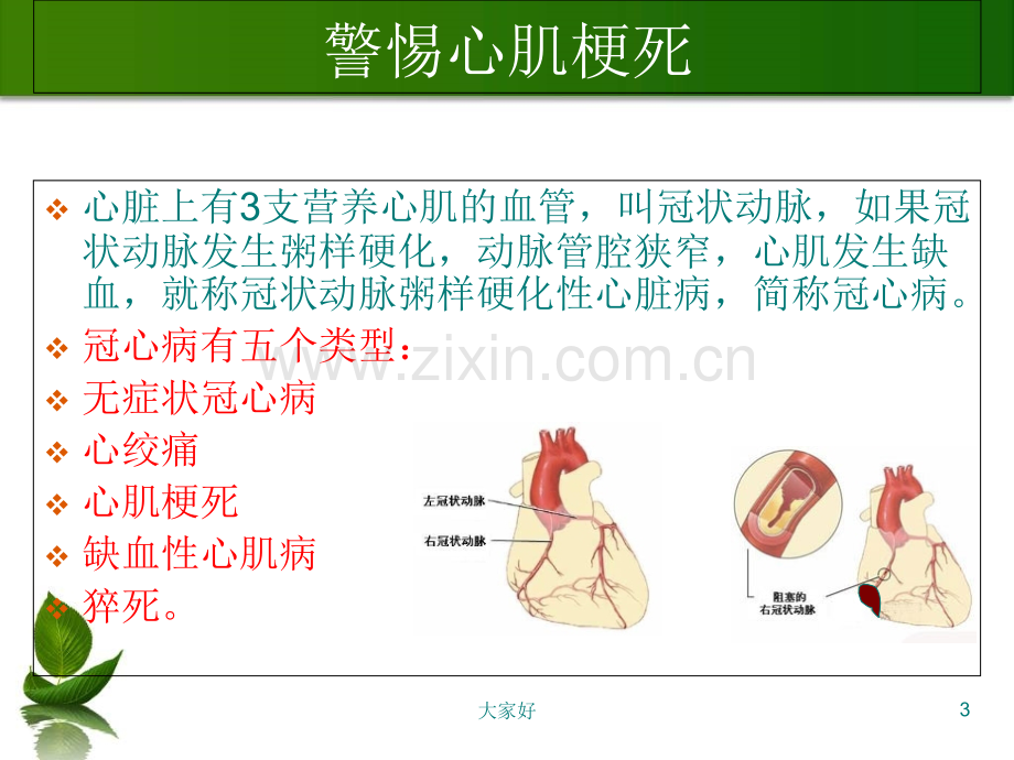 中老年人冬季保健知识讲座一.ppt_第3页