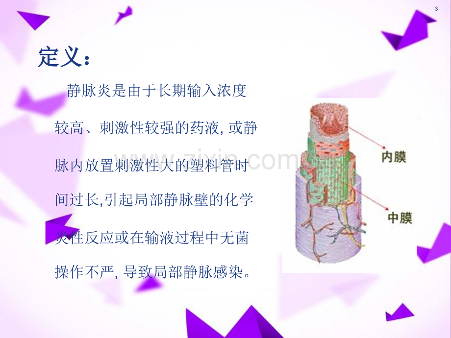 静脉炎的预防和处理-.ppt_第3页