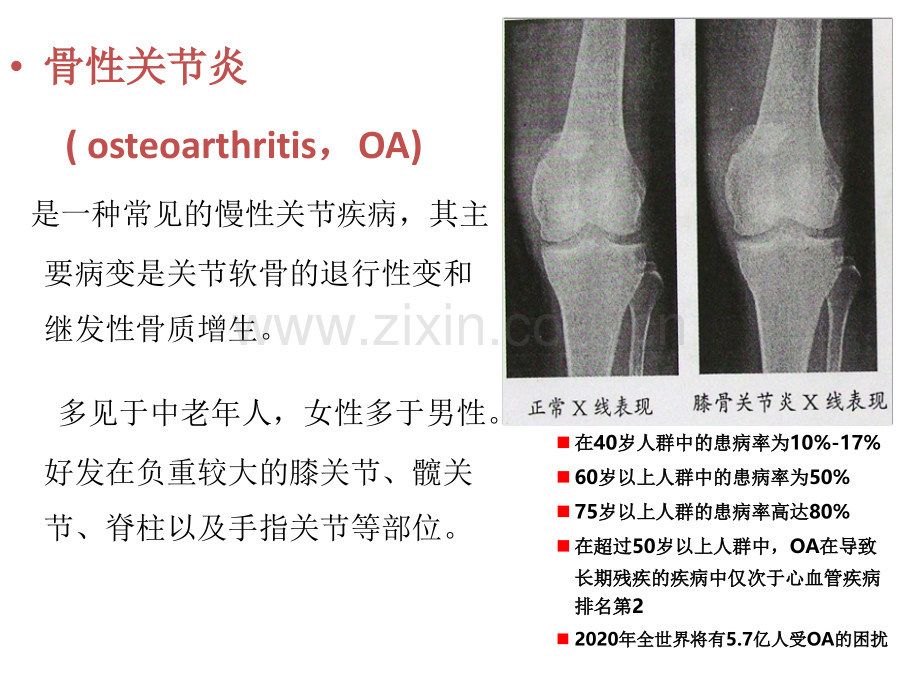 从骨关节炎指南演变看NSAIDs在骨关节中的意义讲义.pptx_第2页