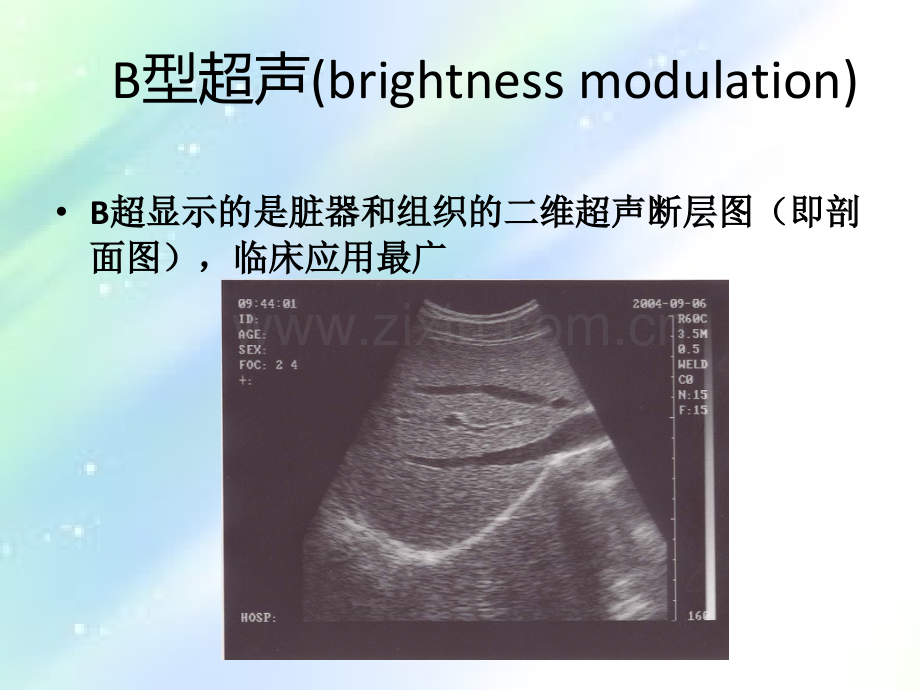 B超机使用.ppt_第2页