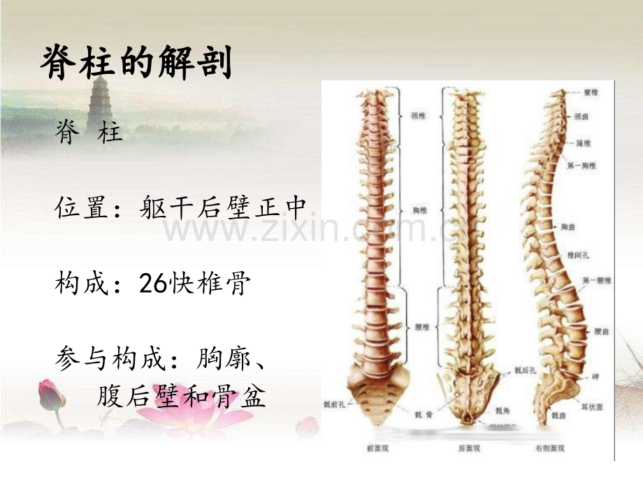 脊柱骨折的急救与护理新.ppt_第3页