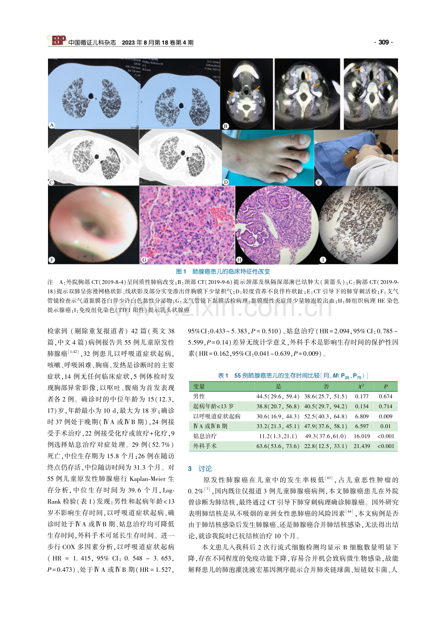 儿童肺腺癌1例病例报告.pdf_第2页