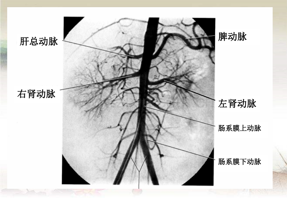 腹部血管解剖与变异.ppt_第3页