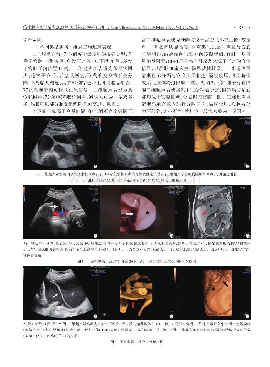 二维联合三维超声在中晚孕期宫腔内条索状回声诊断中的临床价值.pdf_第3页