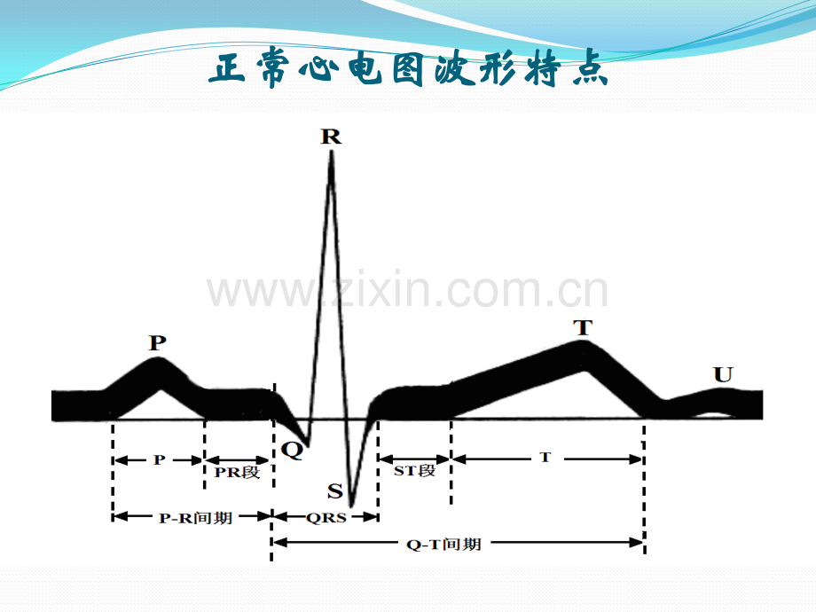 常见异常心电图的识别及处理副本.pptx_第2页