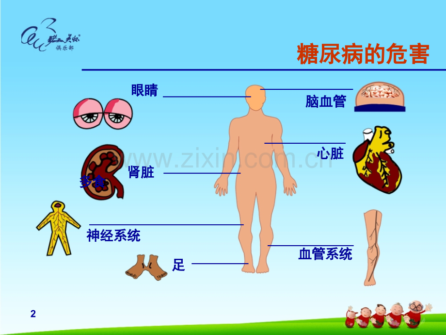 医学糖尿病与眼病.pptx_第2页