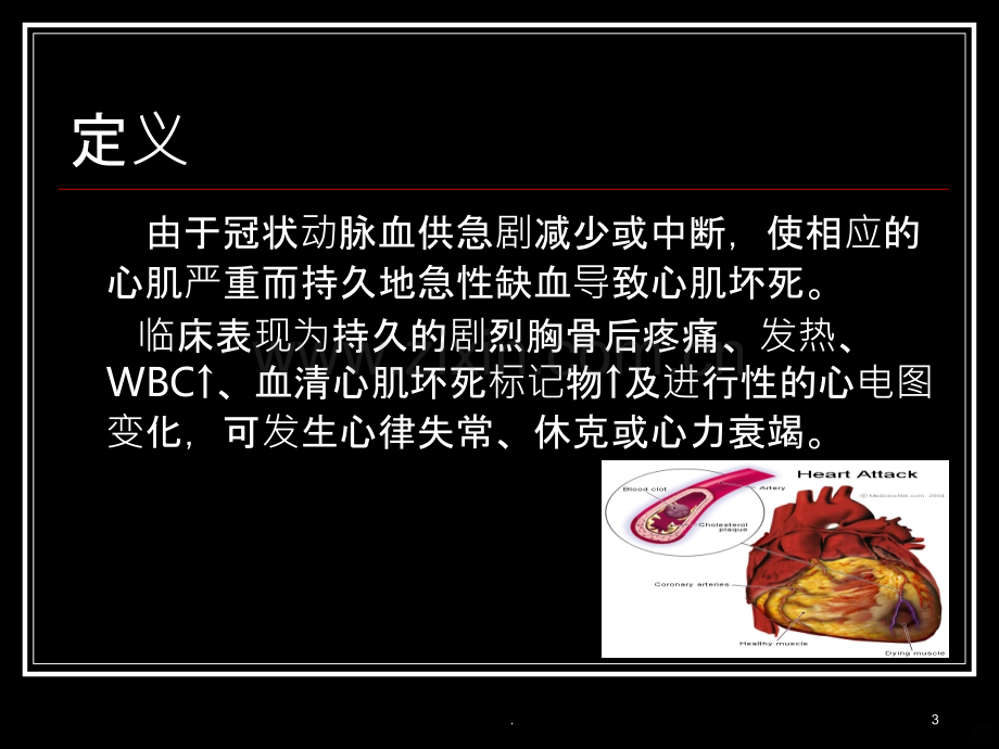 急性ST段抬高型心肌梗死.ppt_第3页