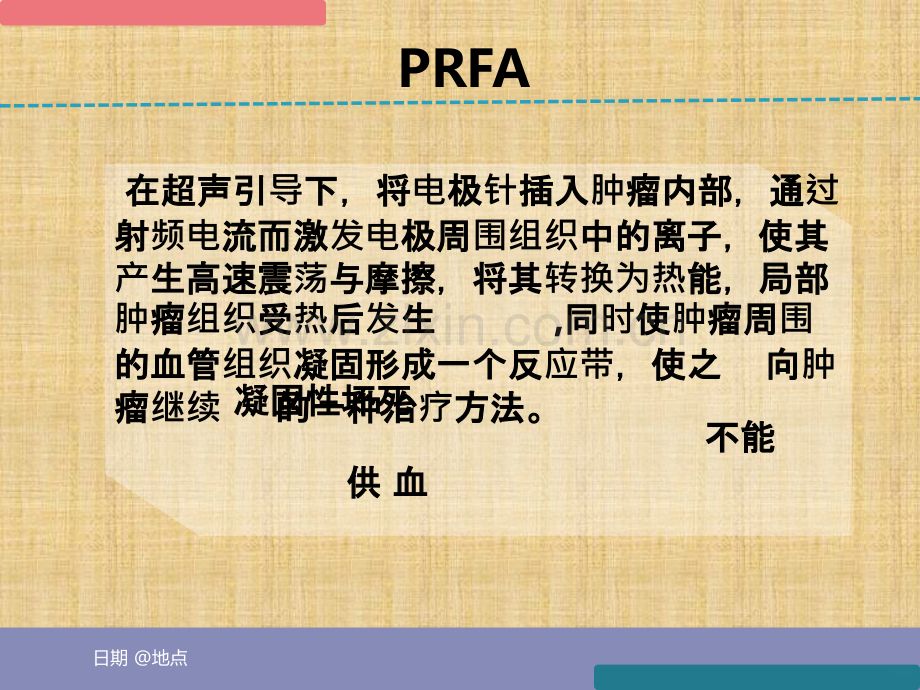 射频消融治疗.ppt_第2页