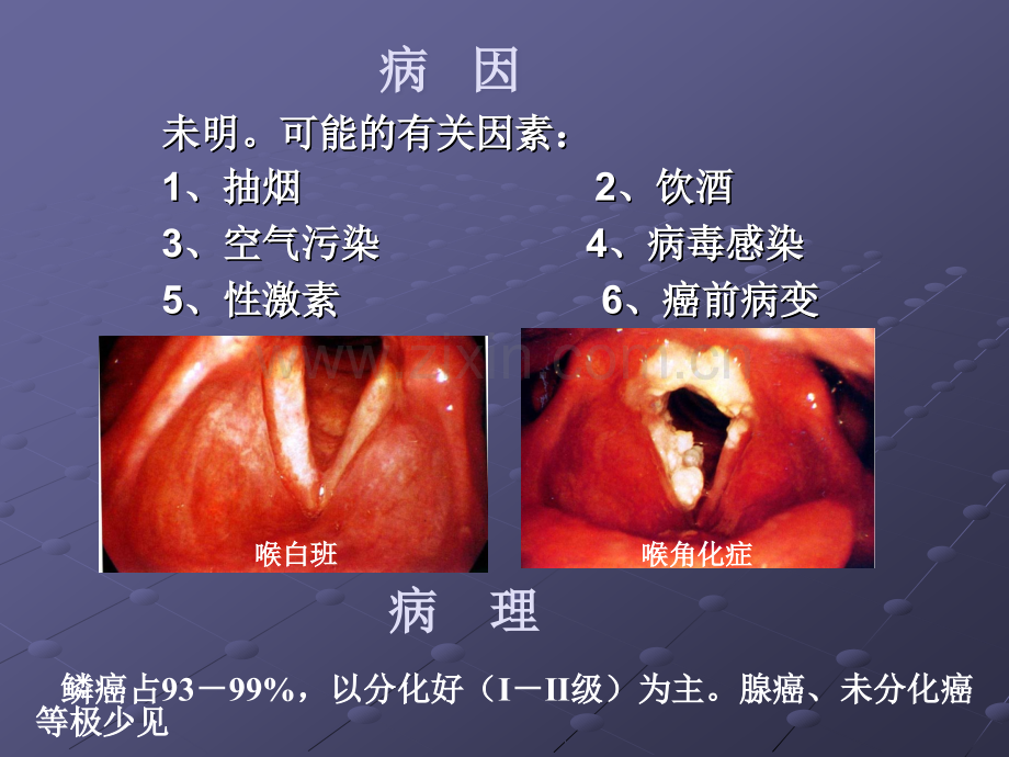 喉癌的护理.ppt_第3页