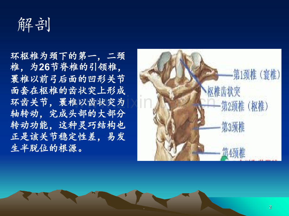 寰枢关节半脱位的治疗与护理2(1).ppt_第2页