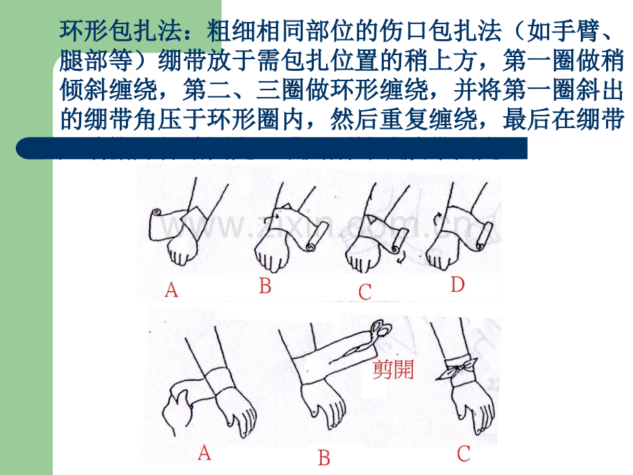 急救-包扎技术.ppt_第3页