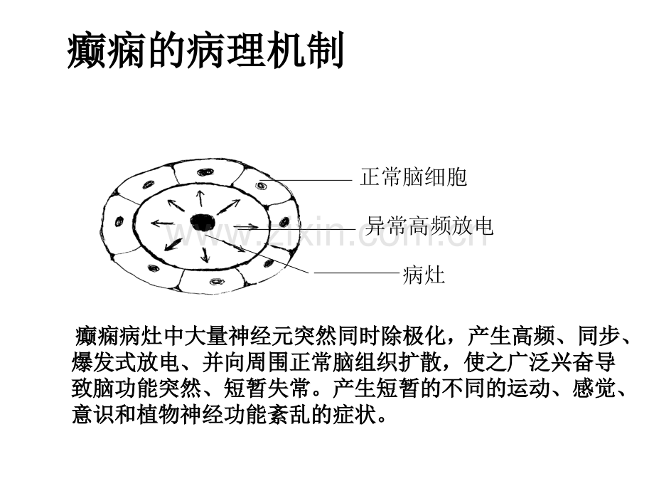 抗癫痫药物介绍.ppt_第3页