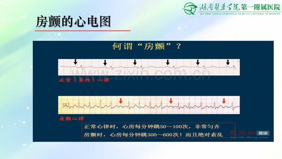 房颤抗凝出血评估.ppt_第3页