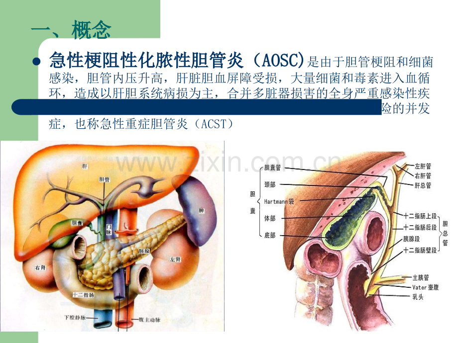 急性梗阻性化脓性胆管炎.ppt_第2页