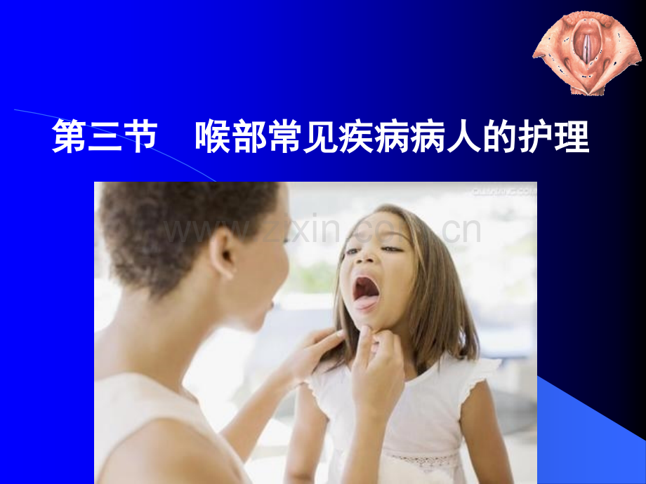 喉部常见疾病病人的护理ppt.ppt_第1页