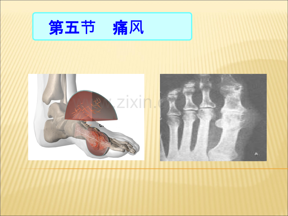 护士考试内科护理学-内分泌代谢性疾病病人护理.ppt_第2页