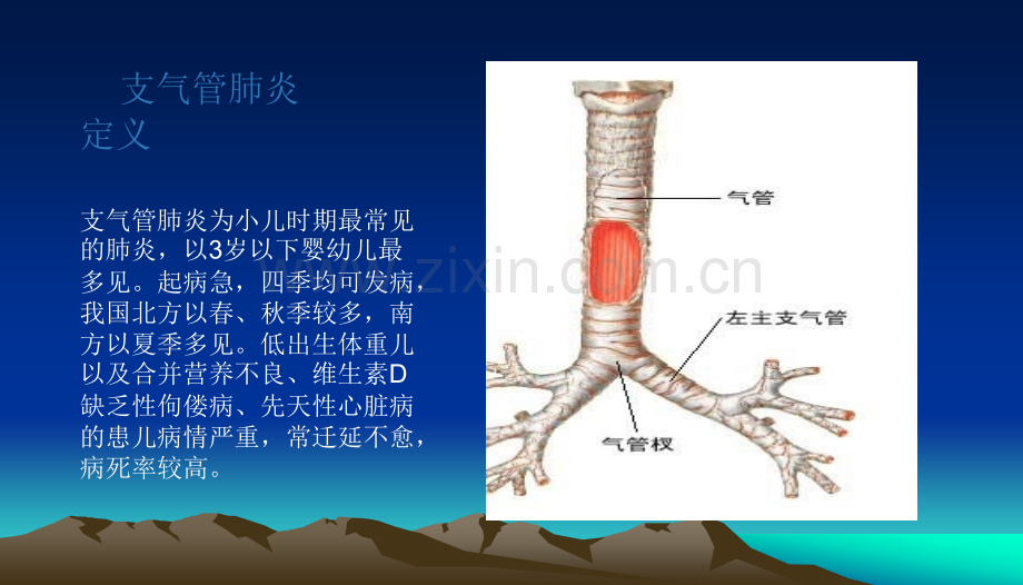 护理查房-小儿支气管肺炎整理版.ppt_第2页