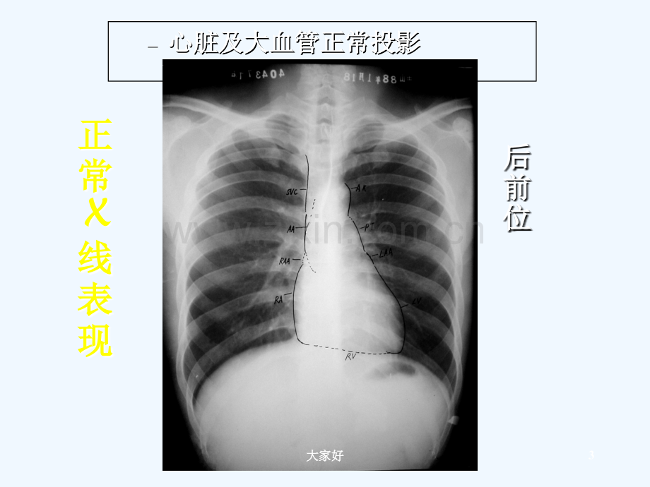 心脏常规线检查.ppt_第3页