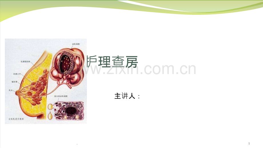 急性乳腺炎护理查房课件.ppt_第1页