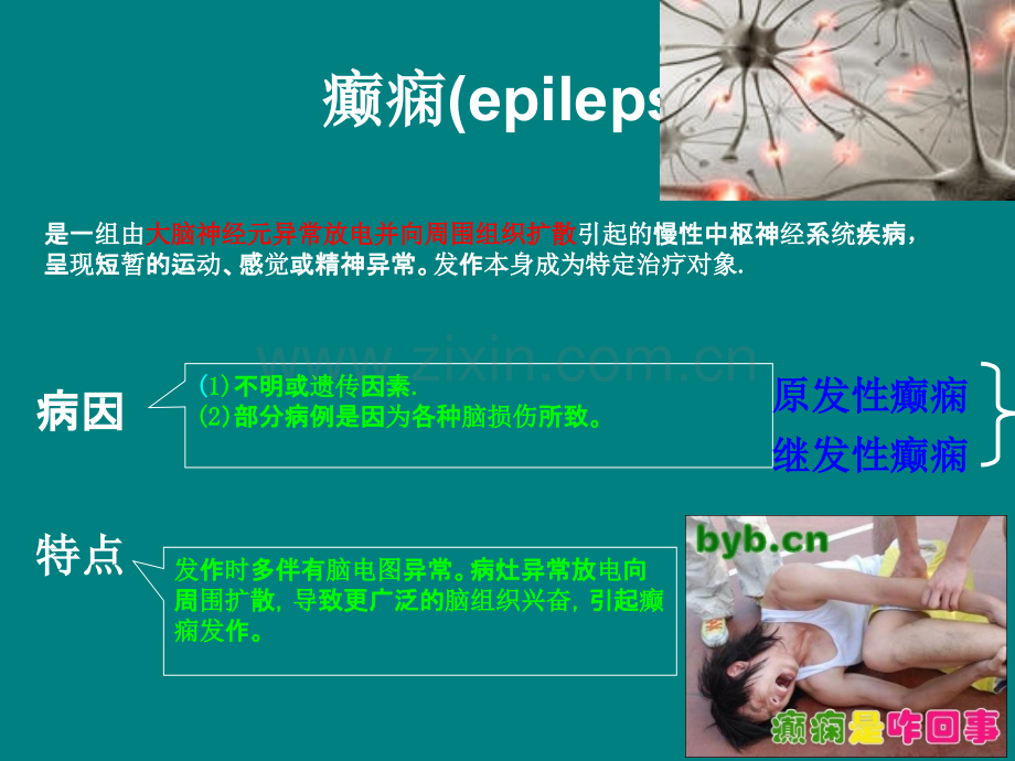 抗癫痫和抗惊厥药.ppt_第3页