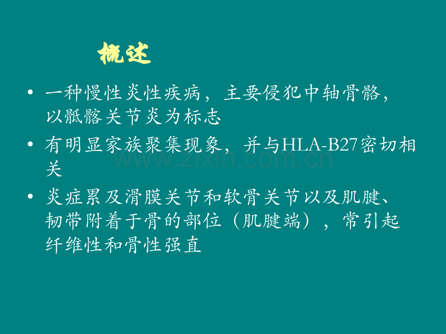 强直性脊柱炎.ppt_第2页