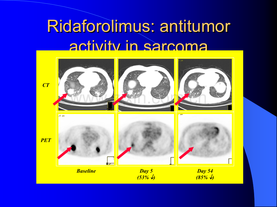 肉瘤化疗SUCCEED-ASCO-2011.ppt_第3页