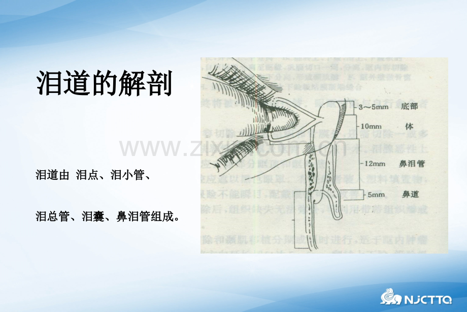 泪道疾病及治疗ppt课件.ppt_第3页