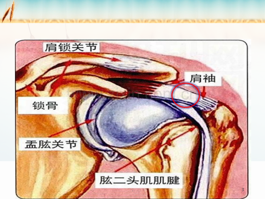 肩袖损伤的护理课件.ppt_第3页