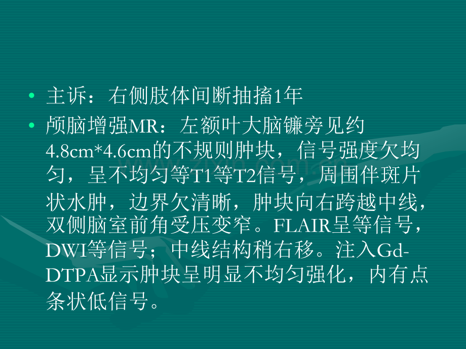 脑膜瘤护理查房.ppt_第3页