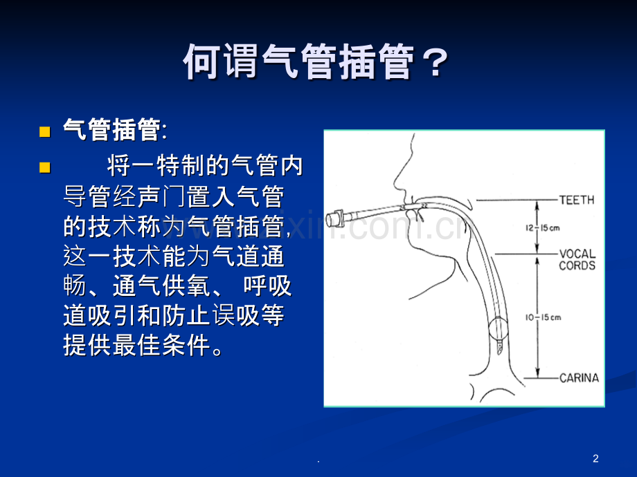 气管插管护理配合.ppt_第2页