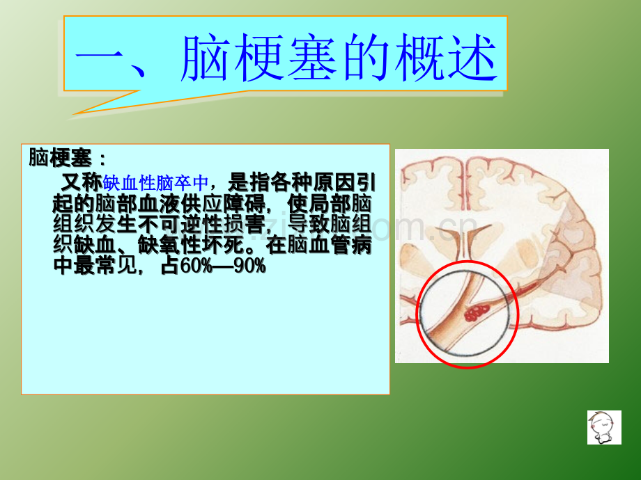 脑梗塞病人的护理查房ppt课件.ppt_第3页