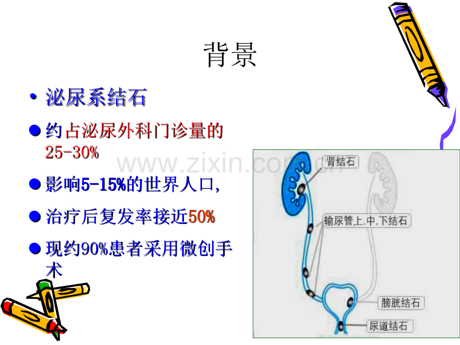 泌尿结石业务学习.ppt_第3页