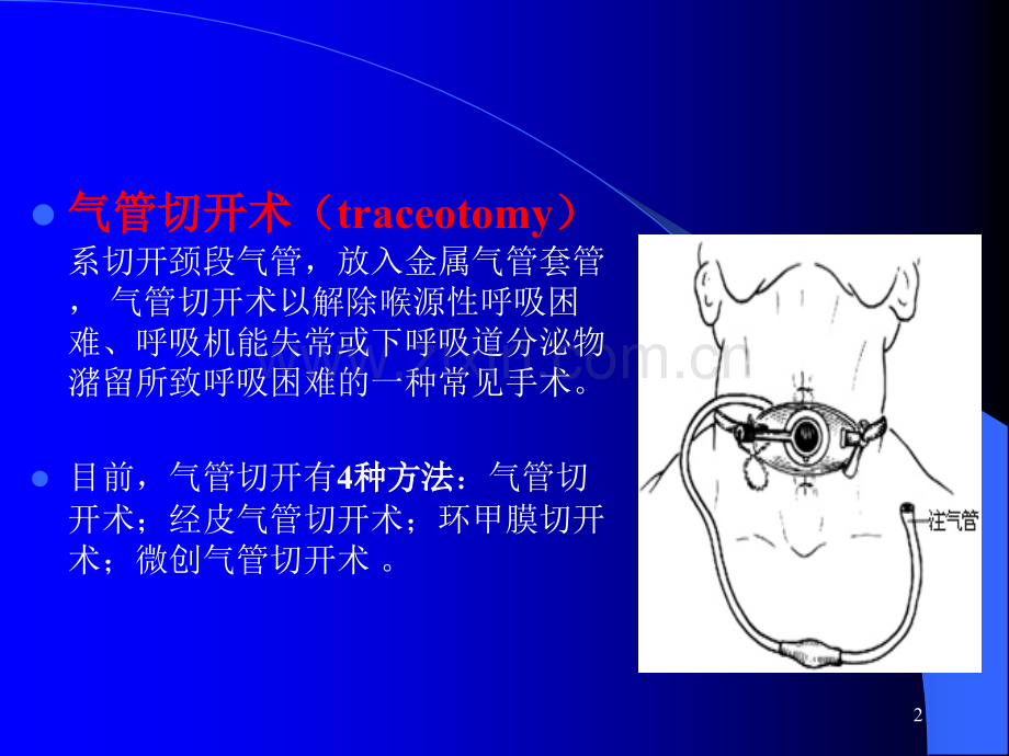 气管切开术后护理与意外脱出的处理方法2011-07.ppt_第2页