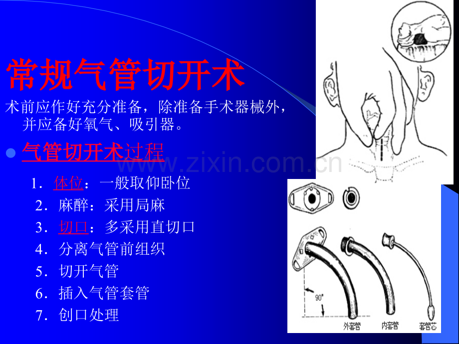 气管切开术后护理与意外脱出的处理方法2011-07.ppt_第3页