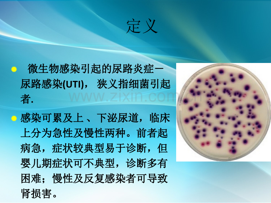 泌尿系感染.ppt_第2页