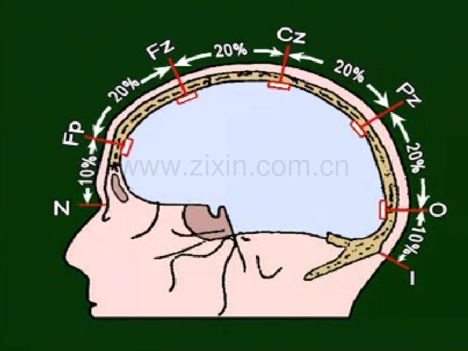 脑电图的基本知识ppt.ppt_第3页