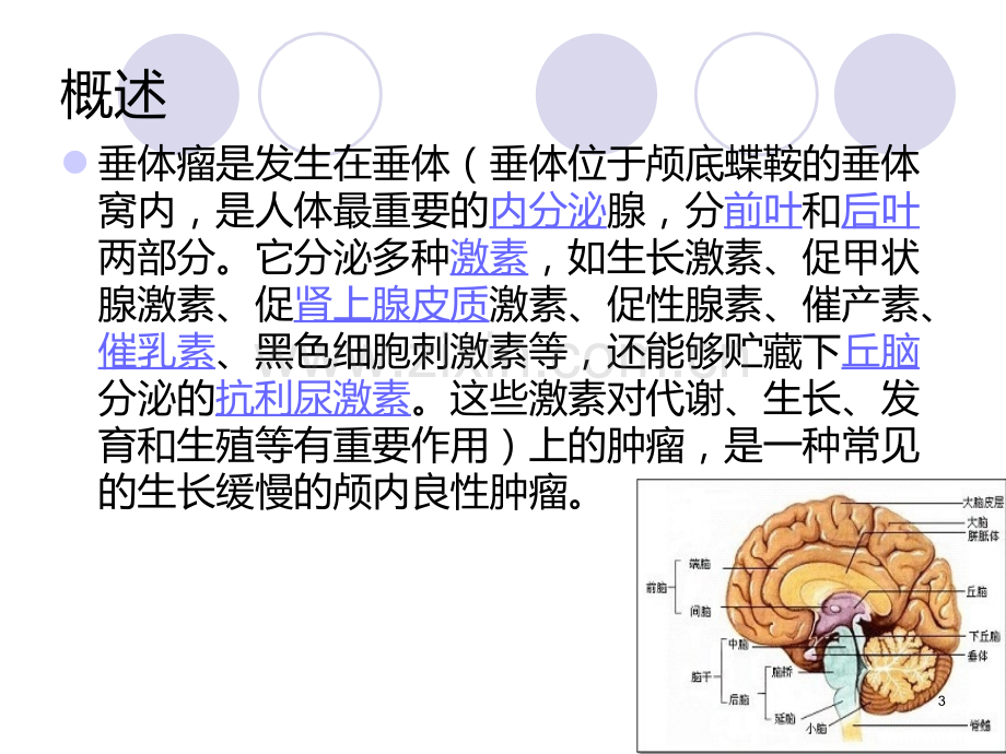 经蝶垂体瘤..ppt_第3页