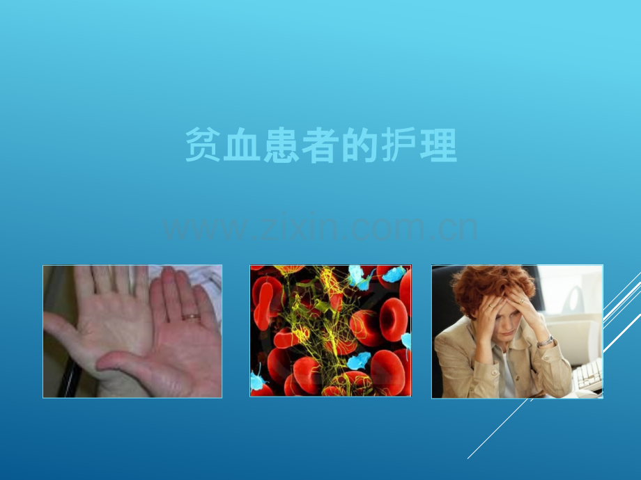 贫血病人的护理.ppt_第1页