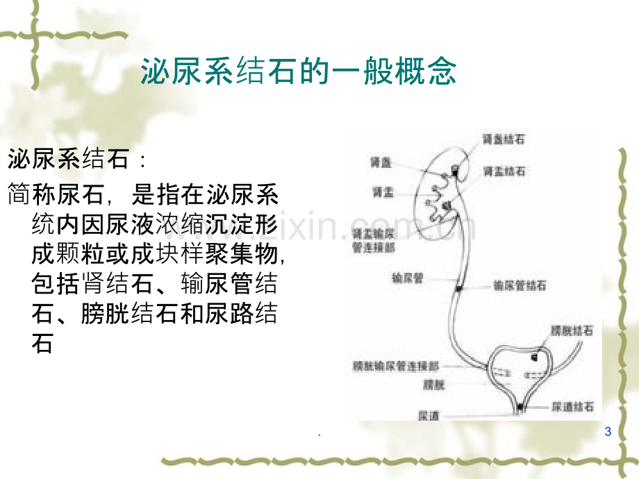 肾结石护理查房.ppt_第3页