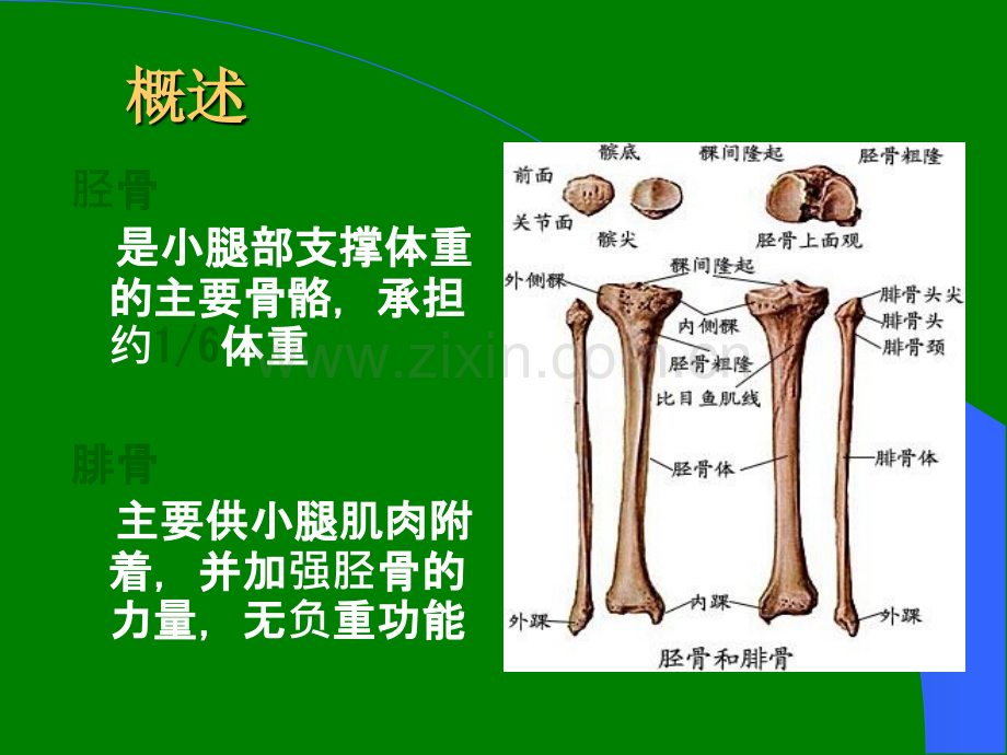 胫腓骨骨折的护理.ppt_第3页