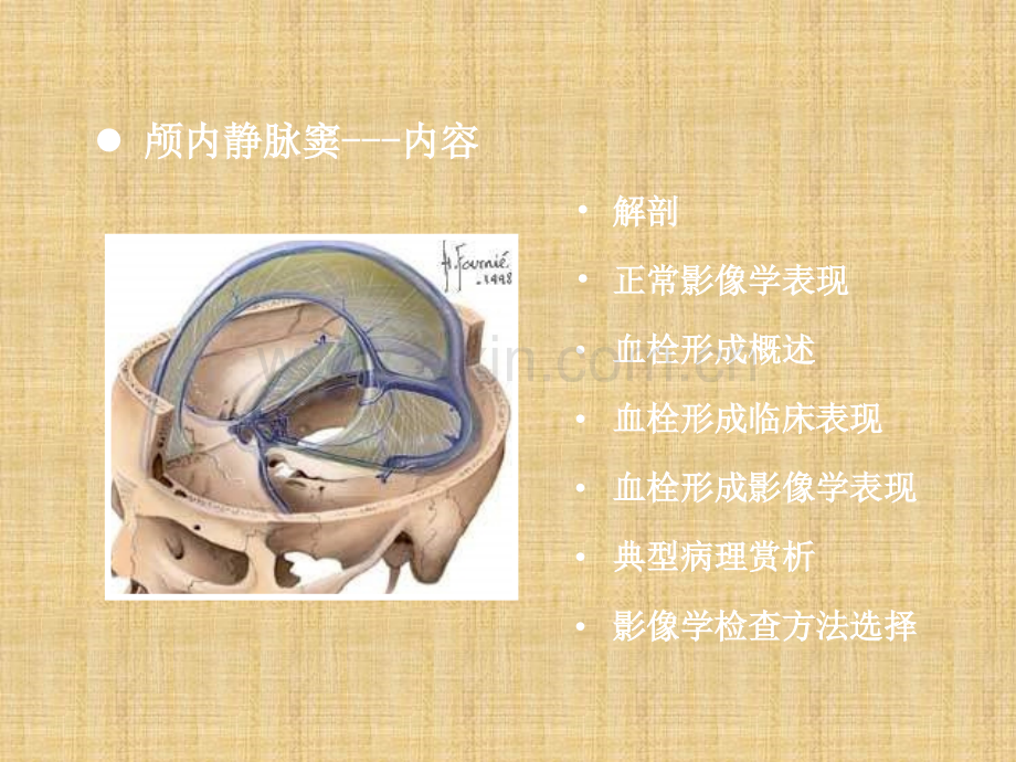 颅内静脉窦血栓形成的特点.pptx_第2页