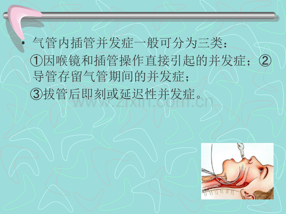 气管内插管并发症.ppt_第2页