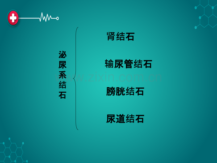 泌尿系统结石病人的护理.ppt_第2页