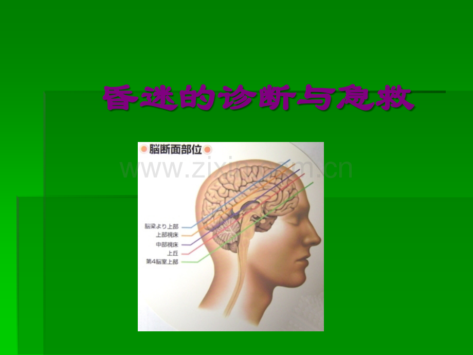 昏迷的诊断与急救.ppt_第1页