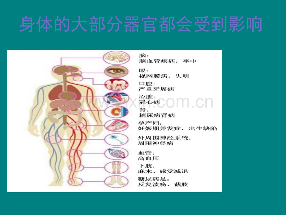 糖尿病视网膜病变的预防及护理.ppt_第2页