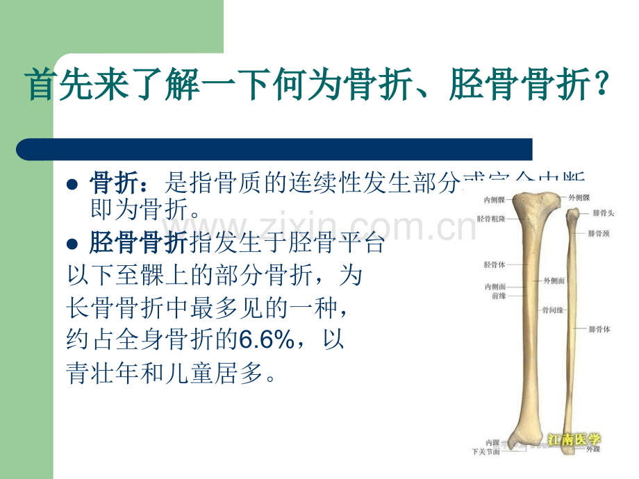 胫骨骨折的护理查房-演示文稿.ppt_第3页