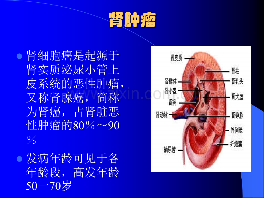 泌尿系统肿瘤-(3).ppt_第3页