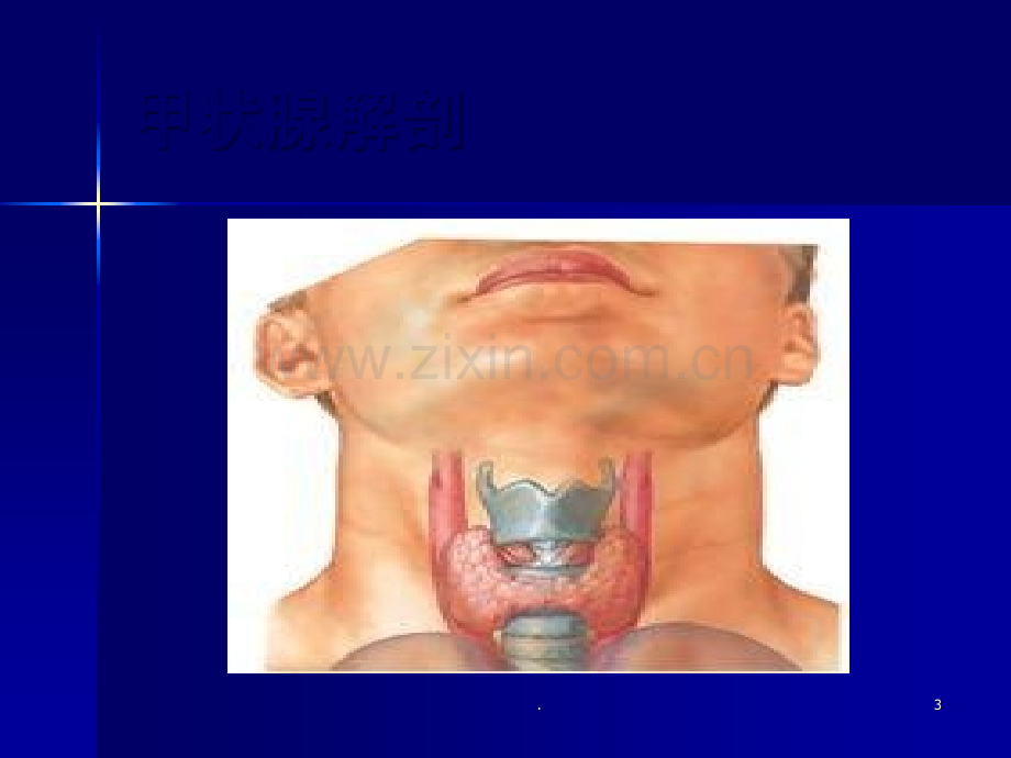 甲状腺癌的护理ppt.ppt_第3页