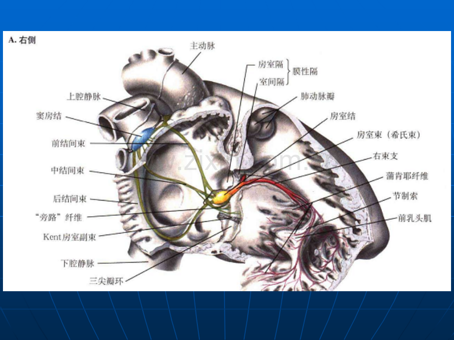 结缔组织病的心脏表现.ppt_第3页